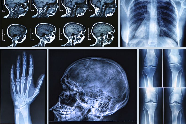 An Image Representing The Diagnostic Imaging Technology: X-Ray, CT, and MRI Scans.