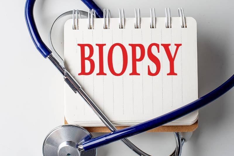 A notepad kept on a table with the word biopsy written on it in red colour and a stethoscope wrapped around it.