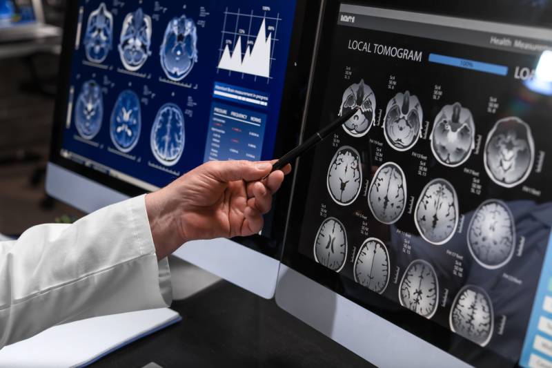 A doctors hand holding a pen pointing at the scan images of a patients brain displayed on a monitor.