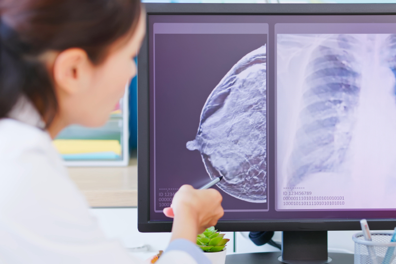 A female radiologist/doctor pointing a pen at the results of mammogram and chest X ray displayed parallelly on the desktop screen in front of her.