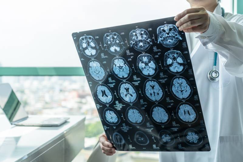 A doctor standing in a consulting room with a laptop on the table, holds an MRI film showing the image results of a patient.