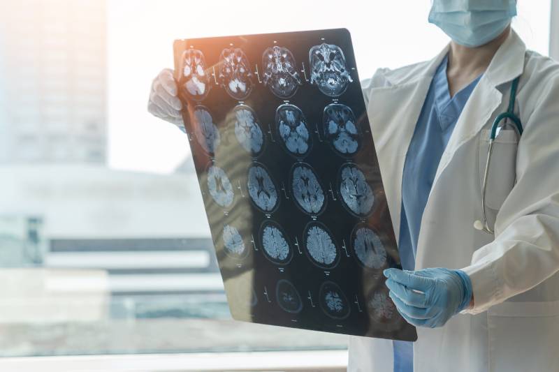 A male doctor holding an MRI film examines the image results of a patient's brain