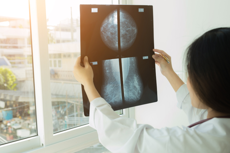A female doctor standing near a window looking at the mammogram film image showing the results of a mammogram test.