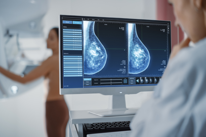 Image of a patient undergoing a mammogram test in the background and a female technician/doctor viewing the results on the desktop infront of her.