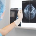 A female doctor or radiologist in blue surgery outfit holding a mammogram result in front of x-ray illuminator.