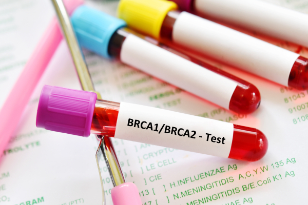 Images of four different colour coded blood sample collection tubes for BRCA1 and BRCA2 test, gene marker for breast cancer.