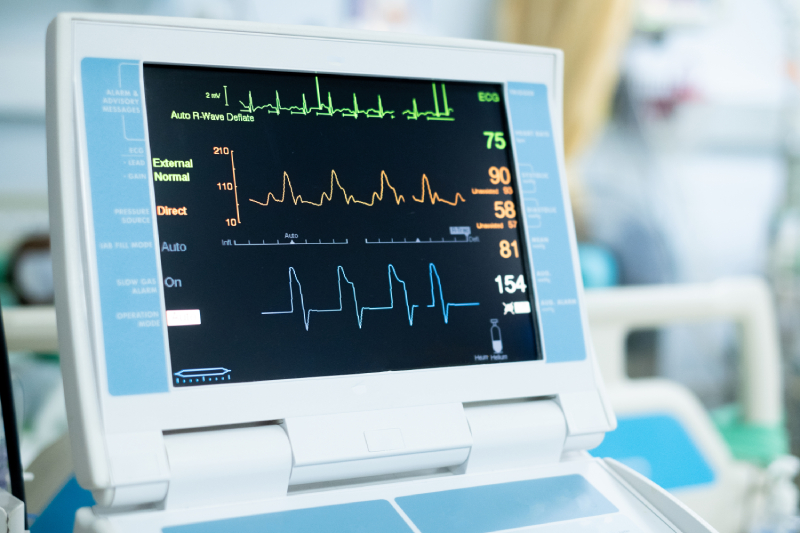 Close up view of an EKG monitor displaying test result,kept in a blurred hospital room background.