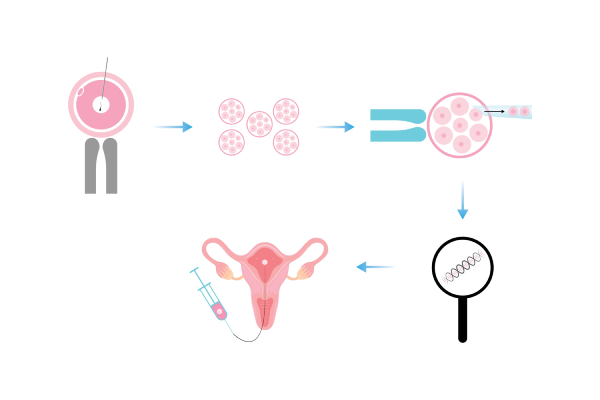 Vector illustration of images related to Preimplantation Genetic Diagnosis (PGD) shown as a process.