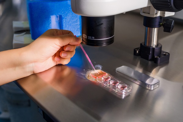 A close up image of an embryologists hand doing insemination process of the egg in the in vitro fertilization laboratory.