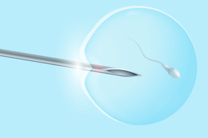 A sky blue themed image showing a medical needle used in IFV, implanting the sperm into the egg.